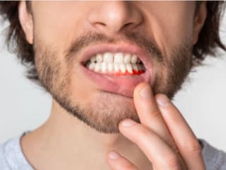 Receding Gums: Can They Grow Back? - LandMark Dentistry