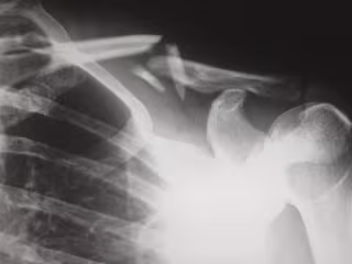 What Injuries Do Robert J. DeBry Car Accident Lawyers Accept?