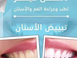 Husam Mohammed on Instagram‎: ”#تصميمي @dentalcare152″‎