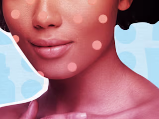 Best acne spot treatments of 2020, according to Experts