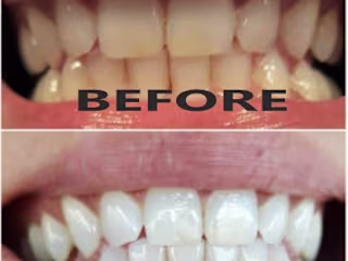 PREMIUM ORAL CARE ON A BUDGET