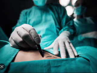 Which Weight Loss Surgery Is Permanent?