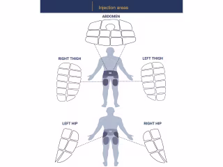An illustration of injection areas