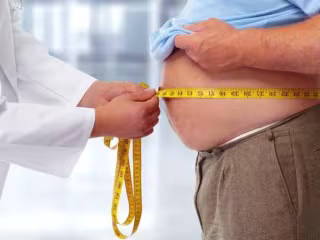 LIFE IN OBESITY 
