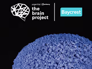 Baycrest x Yogen Früz Pinkberry Brain Project Website Revamp