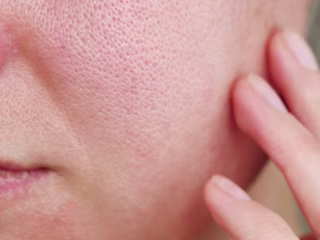 How to Minimize Enlarged Pores: Best Products and Tips for Smoo…