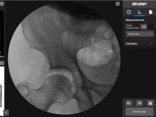 Prototyping Cutting-Edge Medical Devices for Stryker