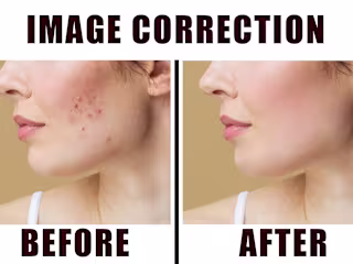 Image correction