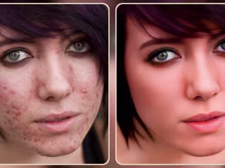 Photo editing
