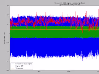 Outlier Detection and Analysis using BMI and HRV Data