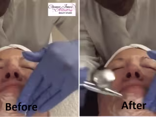 Logo/Watermark Removal From Video