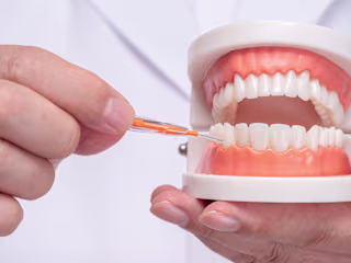 Discover the Best Interdental Brushes for Oral Health