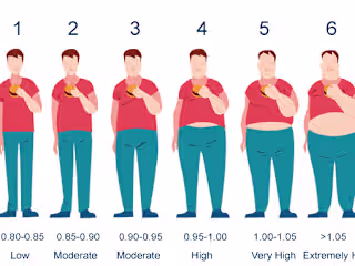 Obesity Level Classification