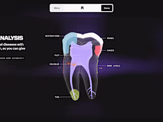 overjet.com