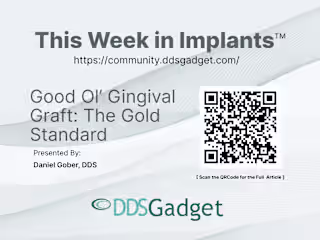 Educational Visual Experience for DDSGadget