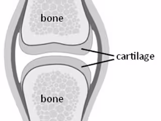 CARTILAGE - MosiPhysio
