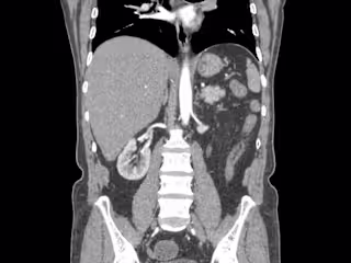 End-to-end pipeline for kidney disease classification 