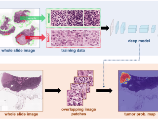 Breast cancer diagnosis using machine learning