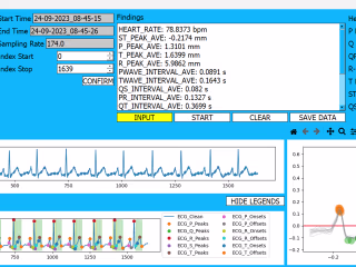 Real-Time Detection and Classification of Heart Arrhythmia