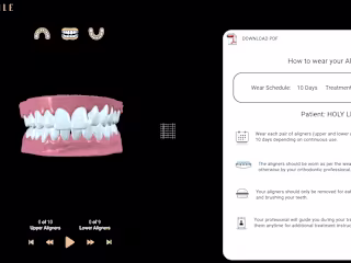3D Viewer for dental clinics
