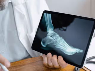 Brand Identity for Orthotics
