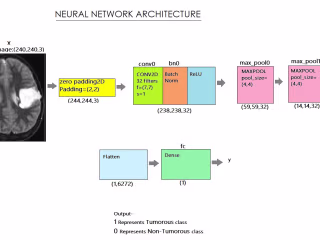 Brain tumor-detection using CNN