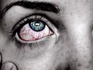How to Cope With Conjunctivitis (Apollo)