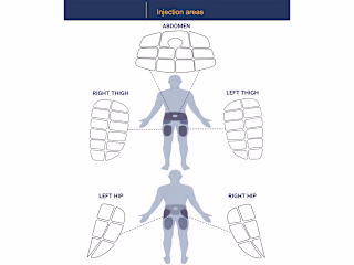 An illustration of injection areas