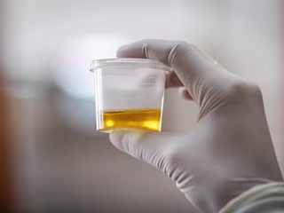 What makes urine yellow? Scientists discover the enzyme guilty