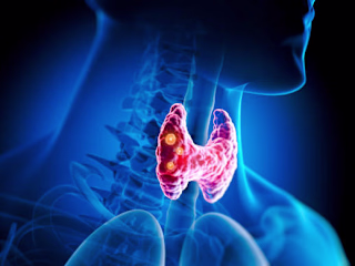 Navigating Thyroid Health: Understanding, Managing, and Thriving