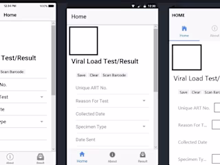 Viral load test for HIV patients