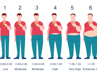 Obesity Level Classification