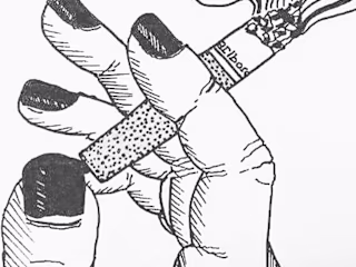 Smoking kills