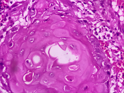Mitosis Cell Classification