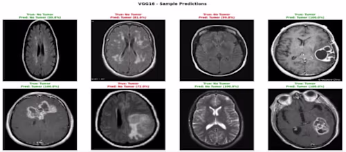 Automated Brain Tumor Detection (VGG16)
