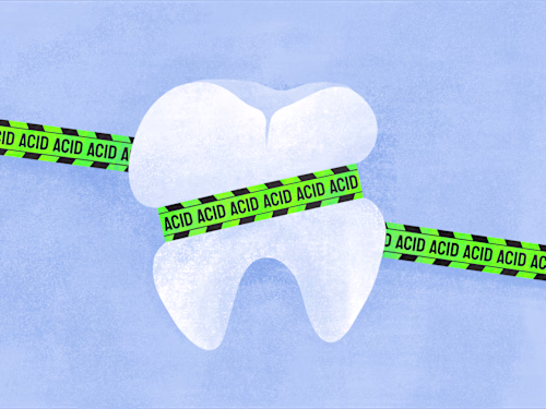 Dental illustrations