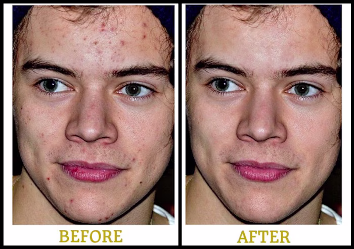 Natural Portrait Retouching
