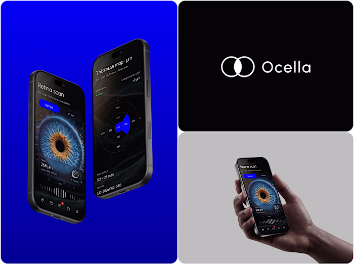 Ocella Eye Exam Results Portal

Clear