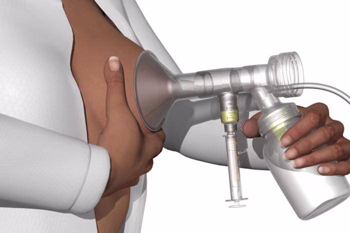 Primo-Lacto: A Closed System For Human Colostrum Collection