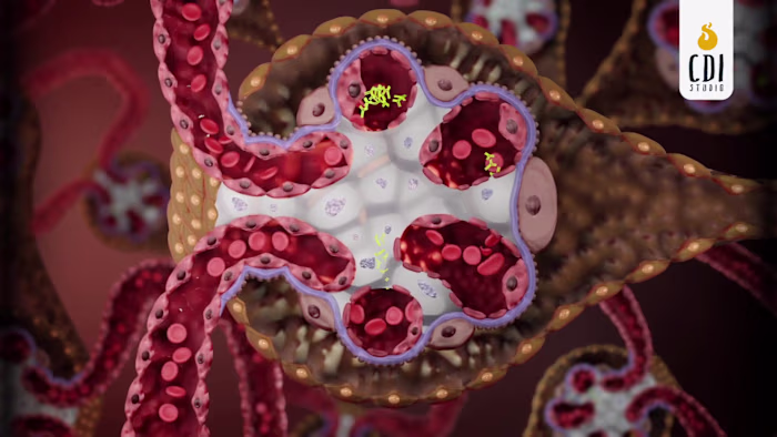 Antibody Deposition in Mesangial Cells: 3D Kidney Animation