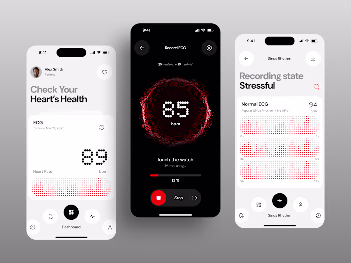 ECG Monitoring Mobile App