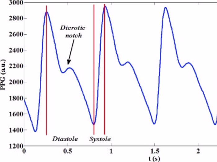 Healtrust: Wearable device for post-operatory monitoring.