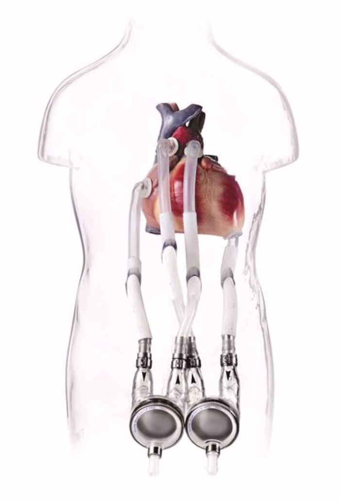 Engaging Blog Post for a Cardiac Device Company