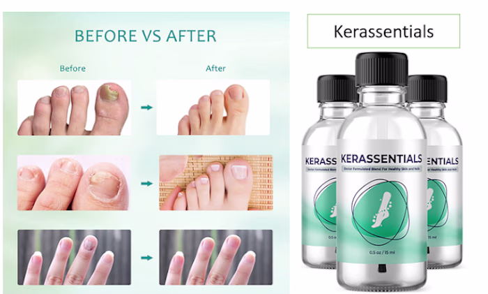 Kerassentials - The Perfect Solution To Every Fungal Infection