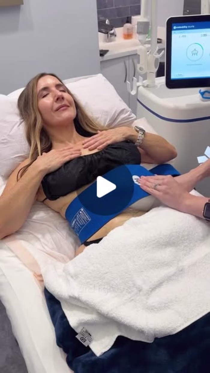CoolSculpting Social Media Campaign