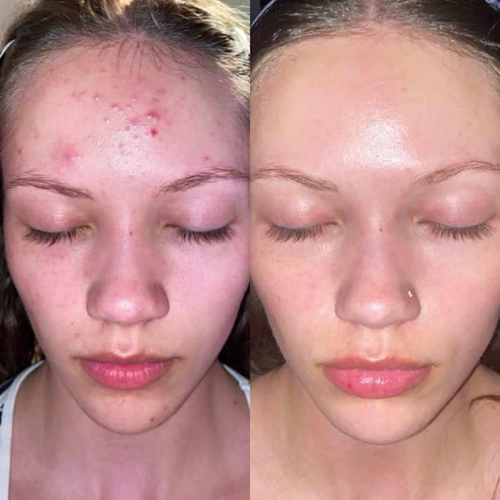 Pure Glow Tallow Skincare Project