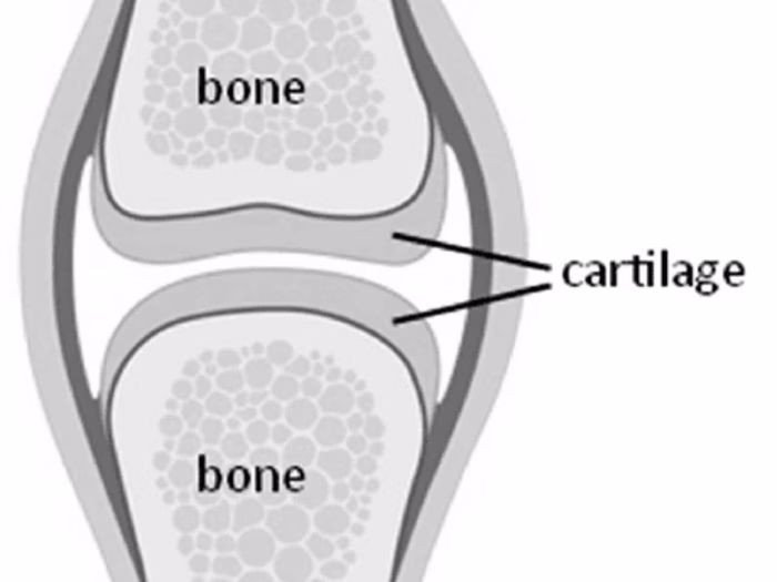 CARTILAGE - MosiPhysio