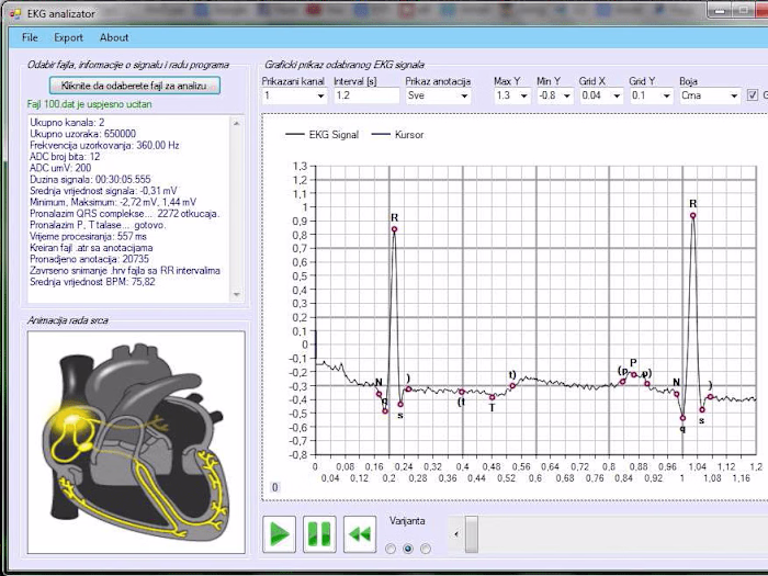 EKG analyzer