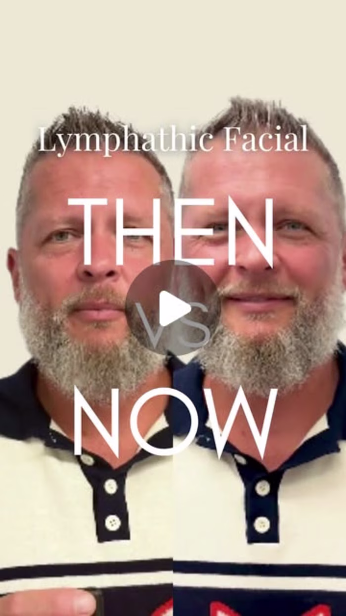 Social Media Campaign for Lymphatic Therapy