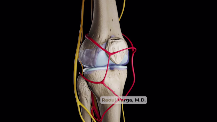 Knee Joint Pain: 3D Medical Animation for Patient Education